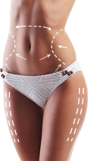 CELSIASHAPE Das neue Figur-Konzept