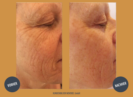 Mezotix Behandlungen in der World of Beauty Mezotix Behandlungen in der World of Beauty
